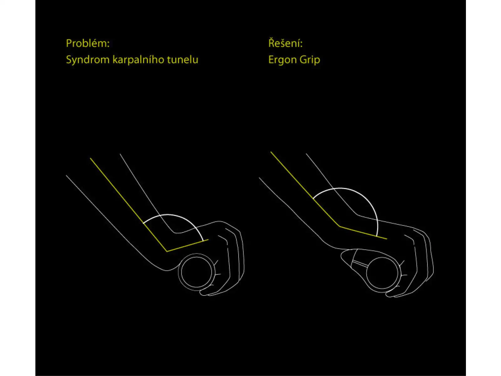 Ergon GP5 BioKork ergonomische Griffe mit Hörnchen.