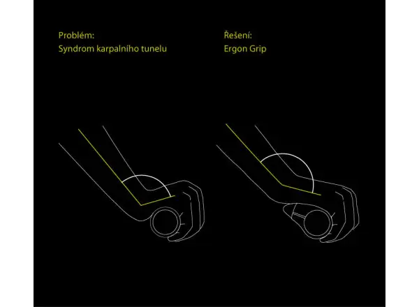 Ergon GP5 BioKork ergonomische Griffe mit Hörnchen.