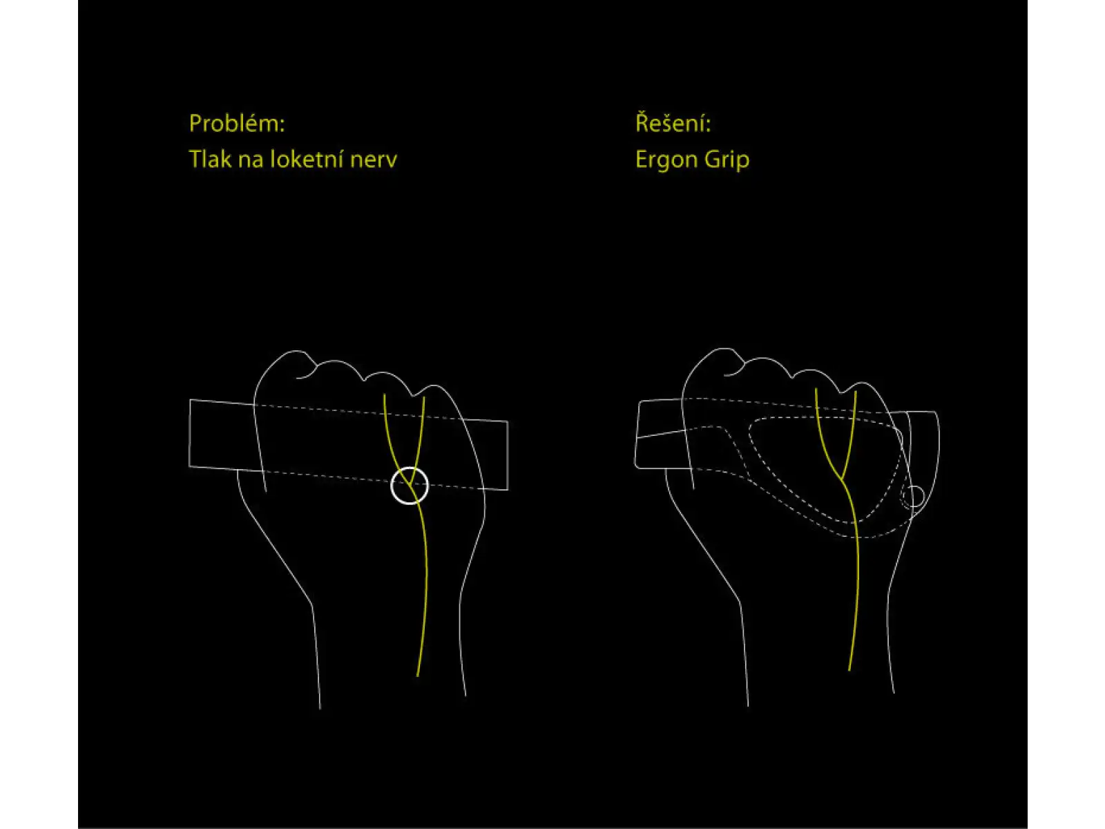 Ergon GP5 BioKork ergonomische Griffe mit Hörnchen.